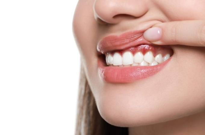 Gum rejuvenation and tissue healing Gachibowli