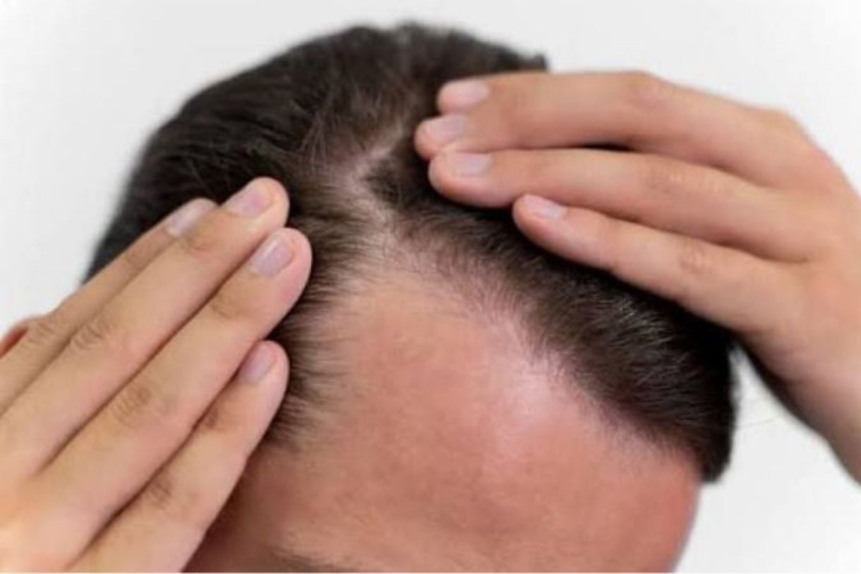 Hair Loss & Scalp Wellness